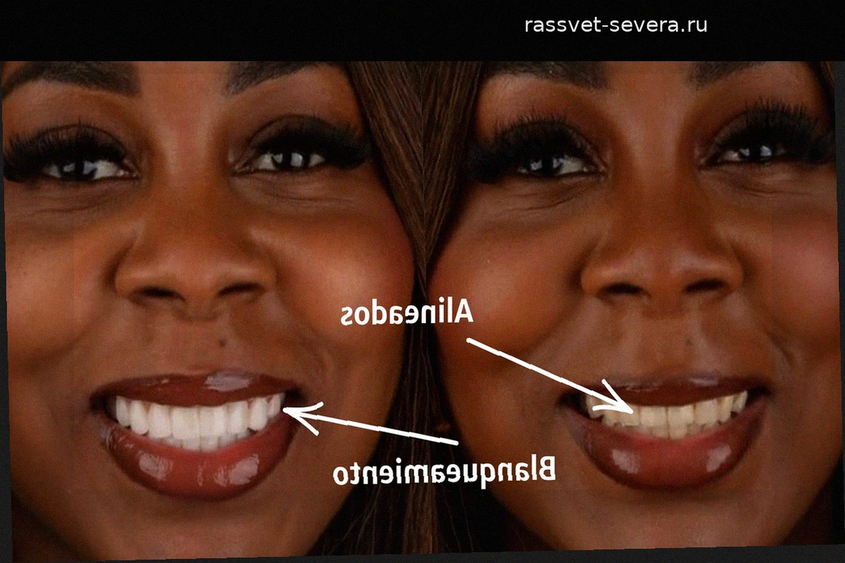 Секрет новой улыбки Шейлы Эбаны: фарфоровые виниры на пять тонов светлее