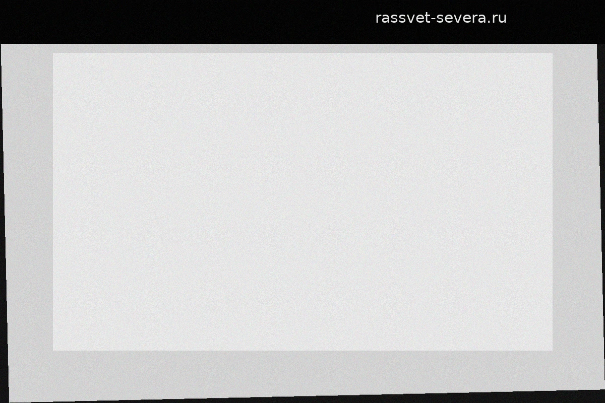 Ана Герра упала с лестницы через две недели после маммопластики